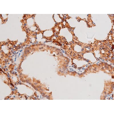 FOXO4 / AFX1 Antibody (phospho-Ser197)