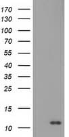 IHC-plus™ S100A12 Antibody (clone 1D1)