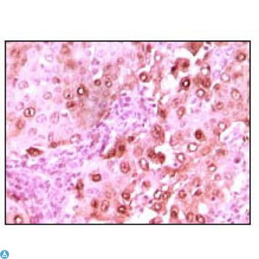 S100A6 / Calcyclin Antibody