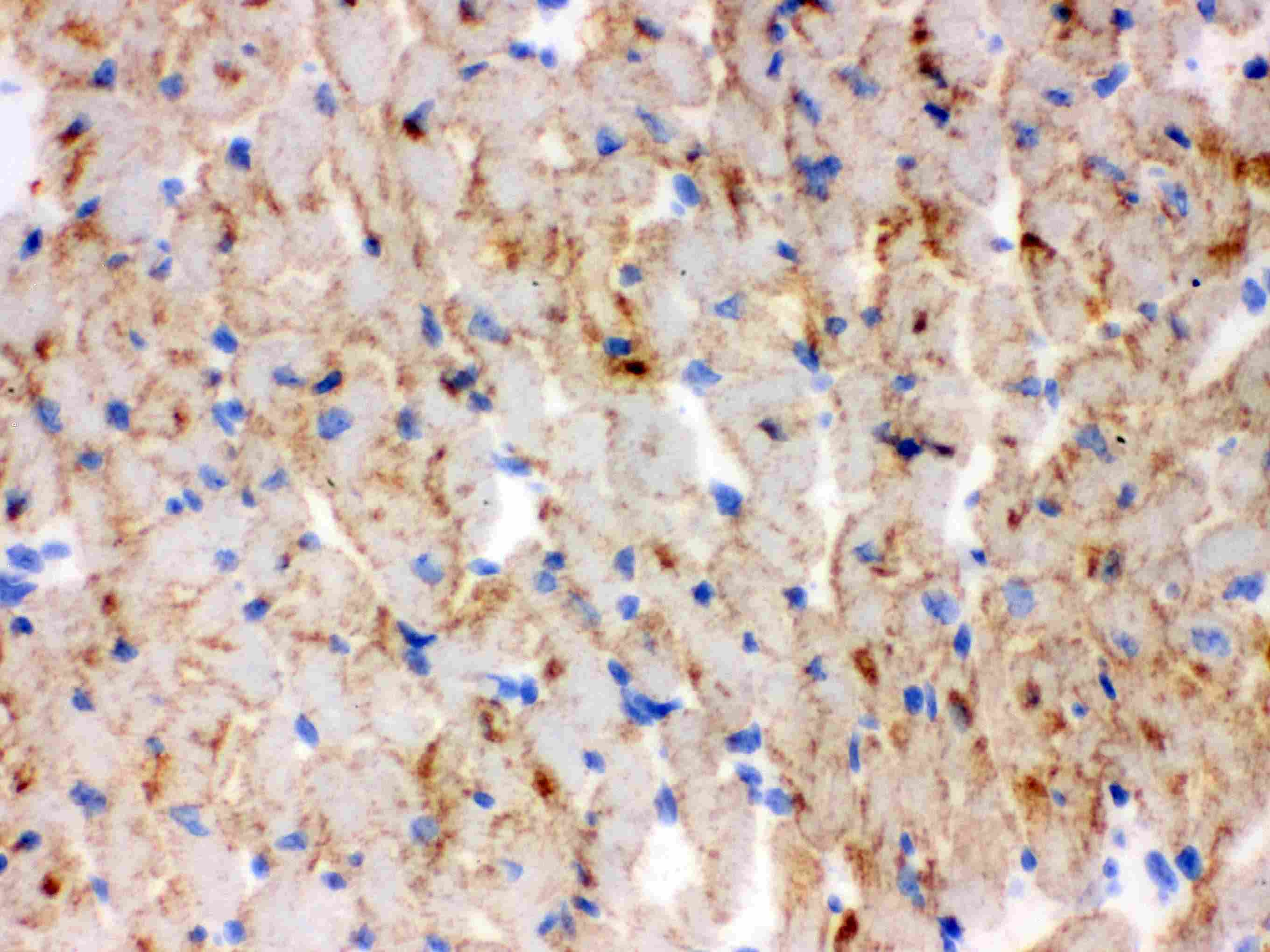 CPT1B Antibody (aa197-226)