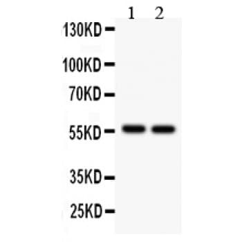 ALDH2 Antibody (aa18-48)