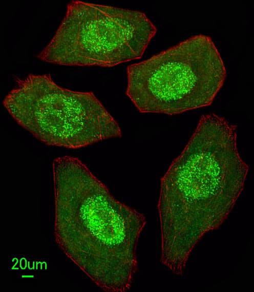 Polyclonal Rabbit anti-Human FANCC Antibody (aa527-555, IHC, IF, WB)