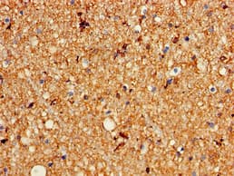 KCNC1 / Kv3.1 Antibody
