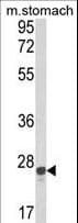 GSTA1 Antibody
