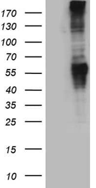 GRM5 / MGLUR5 Antibody