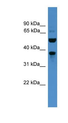 VMD2L3 / BEST3 Antibody (aa21-70)