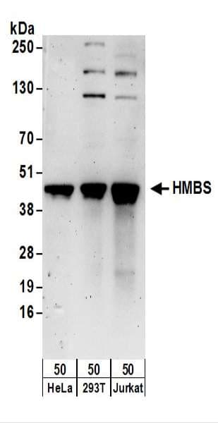 HMBS / PBGD Antibody (aa311-361)