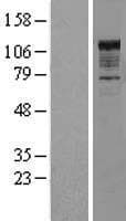 NFKB1 / NF-Kappa-B Protein (Over-Expression Lysate Myc-DDK (Flag))
