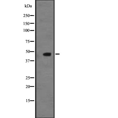 Polyclonal Rabbit anti-Human NMUR2 Antibody (IHC, WB)