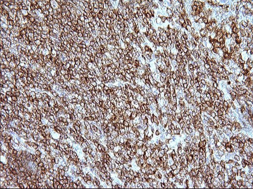ICAM3 / CD50 Antibody (clone OTI1C2)