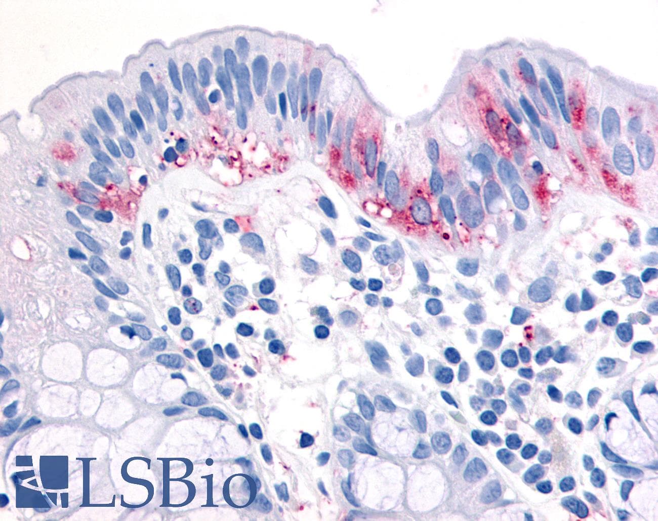 IHC-plus™ Polyclonal Rabbit anti-Human MAP3K8 / TPL2 Antibody (C-Terminus, IHC)