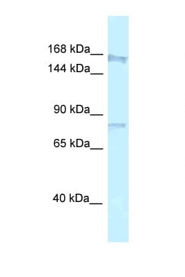 ARHGAP5 / RhoGAP5 Antibody (N-Terminus)