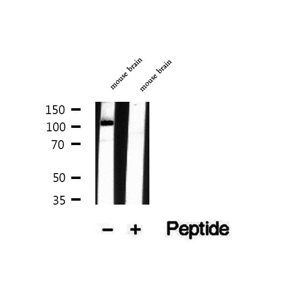 USP33 / VDU1 Antibody