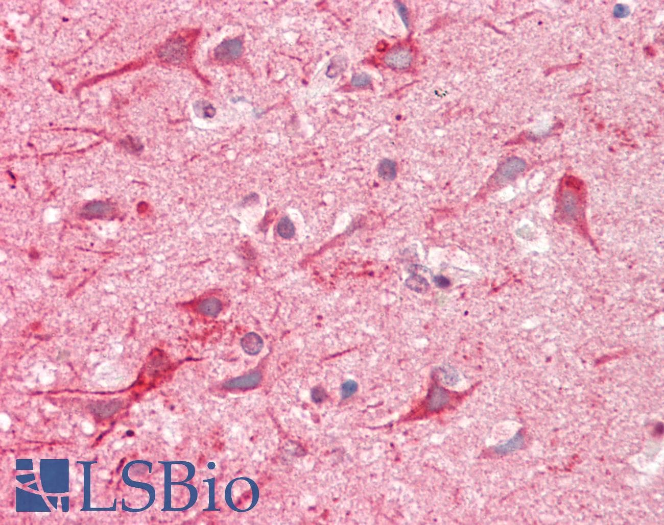 IHC-plus™ NF-L / NEFL Antibody