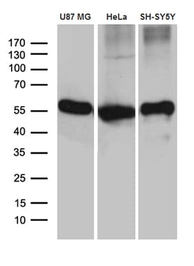 GDI1 Antibody (clone OTI1B1)