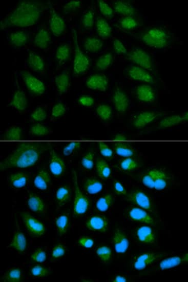 IHC-plus™ SH2D1A / SAP Antibody