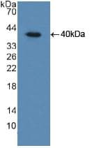 INSR / Insulin Receptor Antibody (aa622-945)