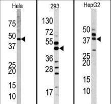 Polyclonal Rabbit anti-Human MAPK1 / ERK2 Antibody (aa154-183, IHC, WB)