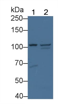 GAA / Alpha-Glucosidase, Acid Antibody (aa70-225)