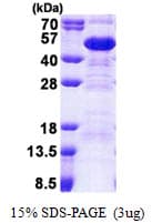 Human SET / TAF-I Protein (Recombinant His)