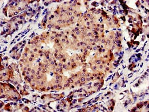 Polyclonal Rabbit anti-Human CBS Antibody (IHC, IF, WB)