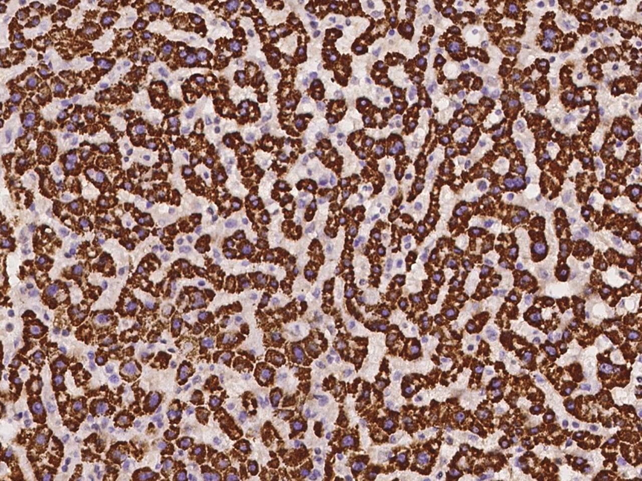 Polyclonal Rabbit anti-Human ALDH5A1 Antibody (IHC, IF)