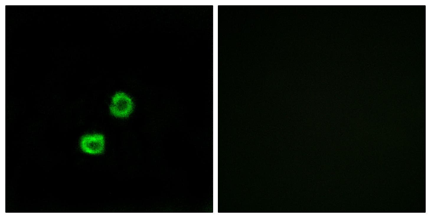 GCNT7 Antibody