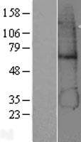 ADH5 Protein (Over-Expression Lysate Myc-DDK (Flag))