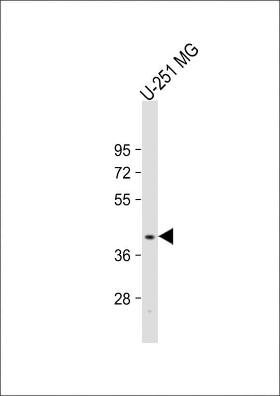 PNPLA5 Antibody (Internal)