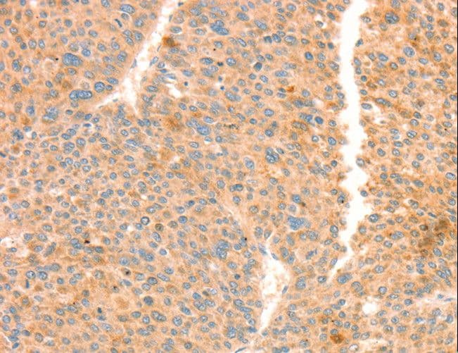Polyclonal Rabbit anti-Human TRPM7 Antibody (IHC)
