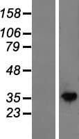 NAGK Protein (Over-Expression Lysate Myc-DDK (Flag))