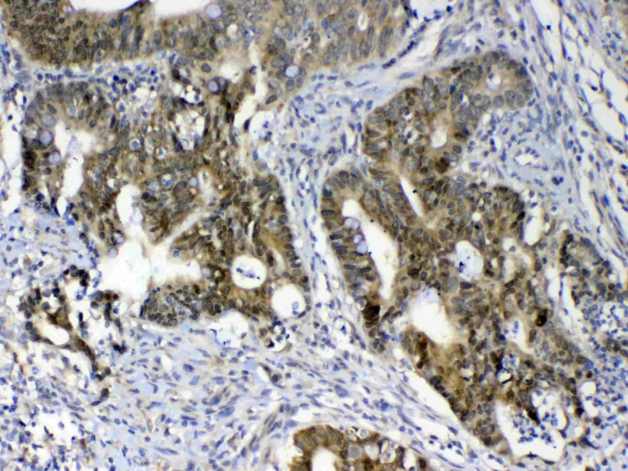 GALE / UDP-Glucose 4-Epimerase Antibody