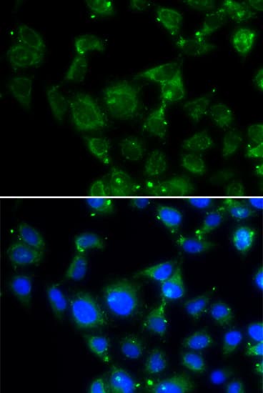 MAPRE2 / EB2 Antibody
