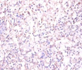 Polyclonal Rabbit anti-Human TACR1 / NK1R Antibody (IHC, WB)