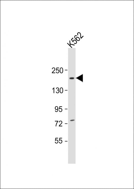 NCOA2 / TIF2 Antibody (aa706-739)