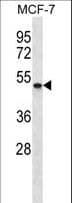 SMYD5 Antibody (aa343-371)