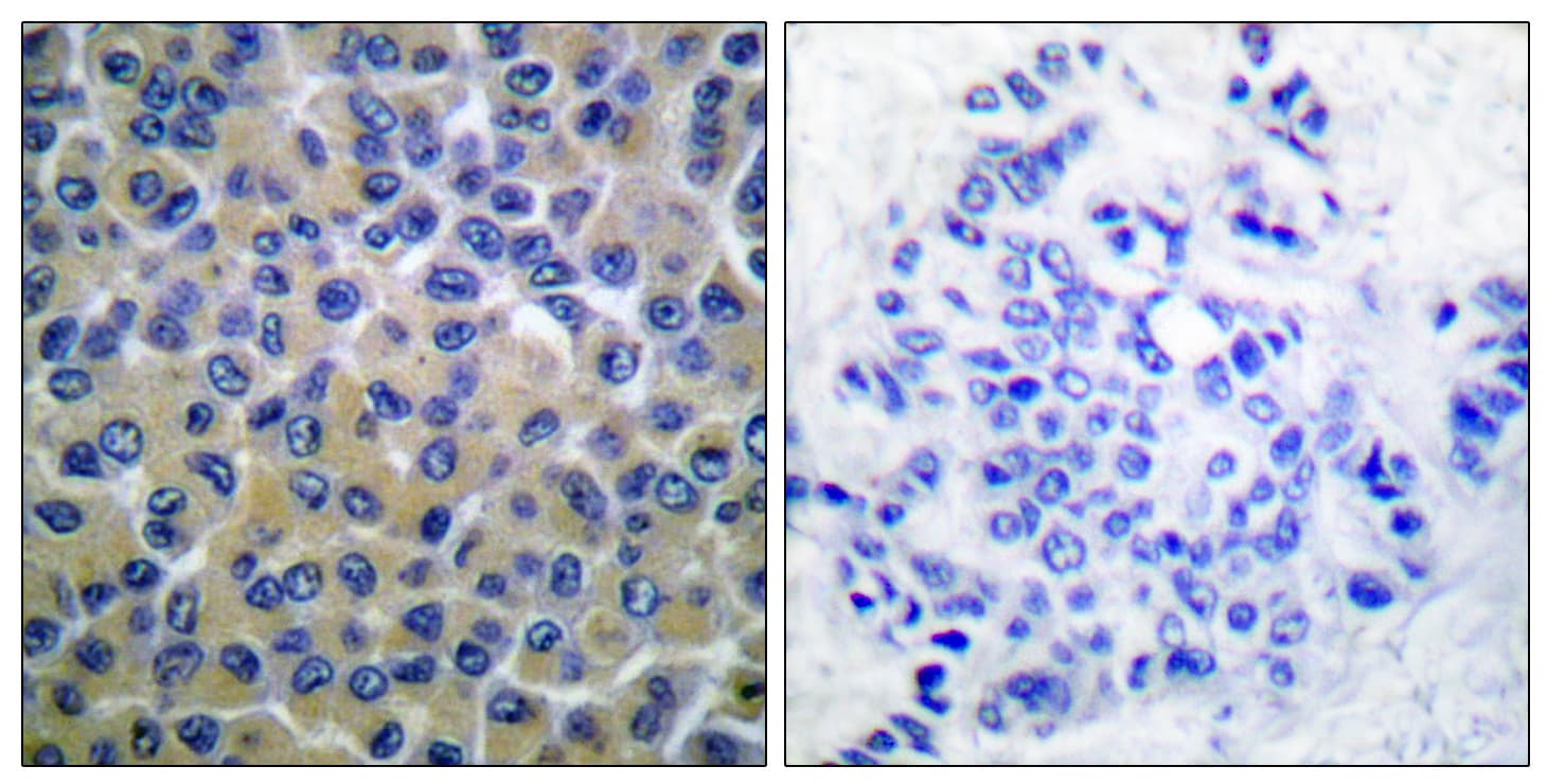 SYK Antibody (phospho-Tyr348)