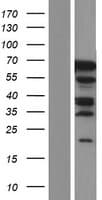 PHF20L1 Protein (Over-Expression Lysate Myc-DDK (Flag))
