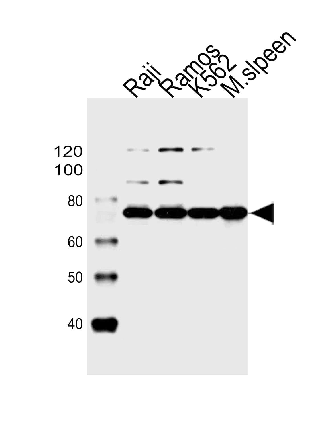 BTK Antibody (aa396-430)