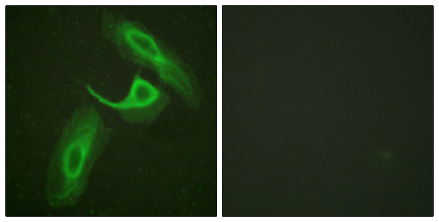 ITGB2 / CD18 Antibody (aa720-769)