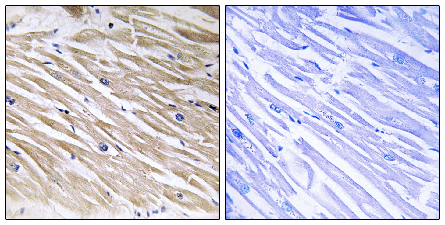 Polyclonal Rabbit anti-Human PEA15 / PEA-15 Antibody (aa70-119, IHC)