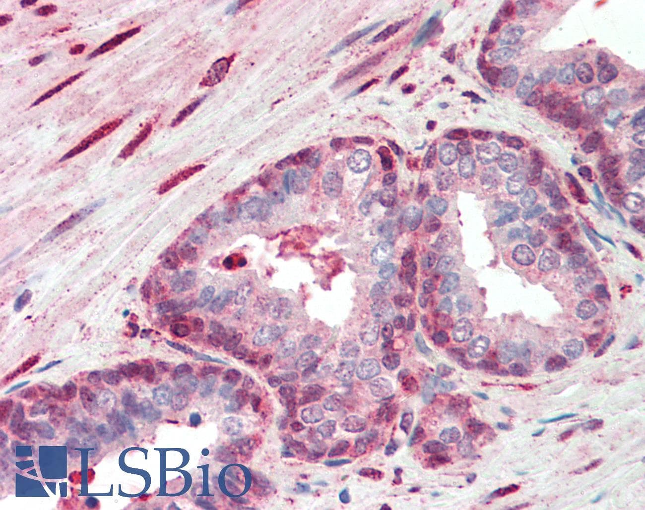 Polyclonal Rabbit anti-Human SRSF2 / SC35 Antibody (C-Terminus, IHC, WB)