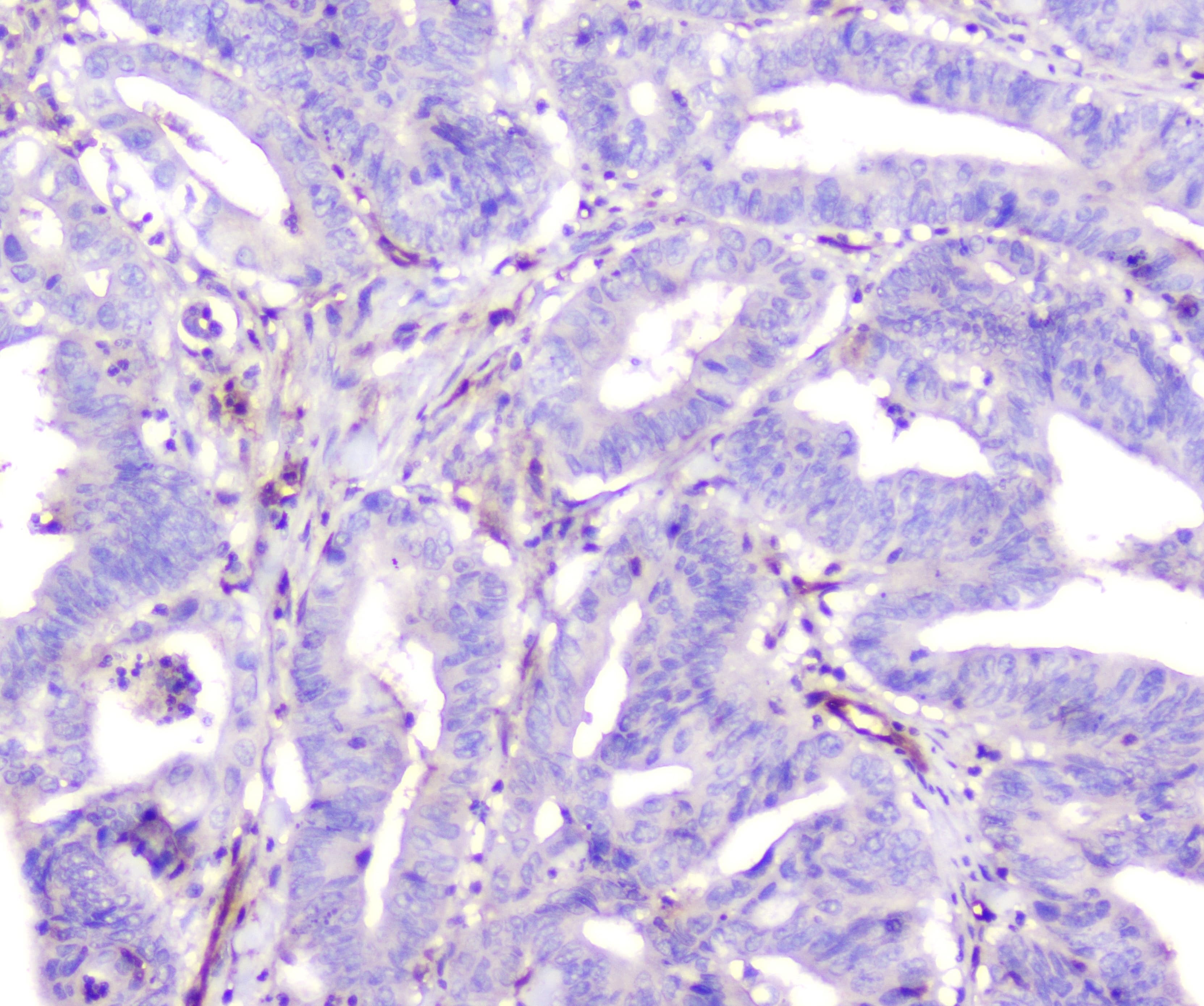 ADA / Adenosine Deaminase Antibody