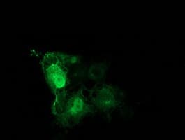 TUBB4 / Tubulin Beta 4 Antibody (clone OTI3F1, Carrier-free)
