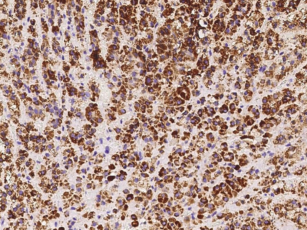 ACADVL Antibody