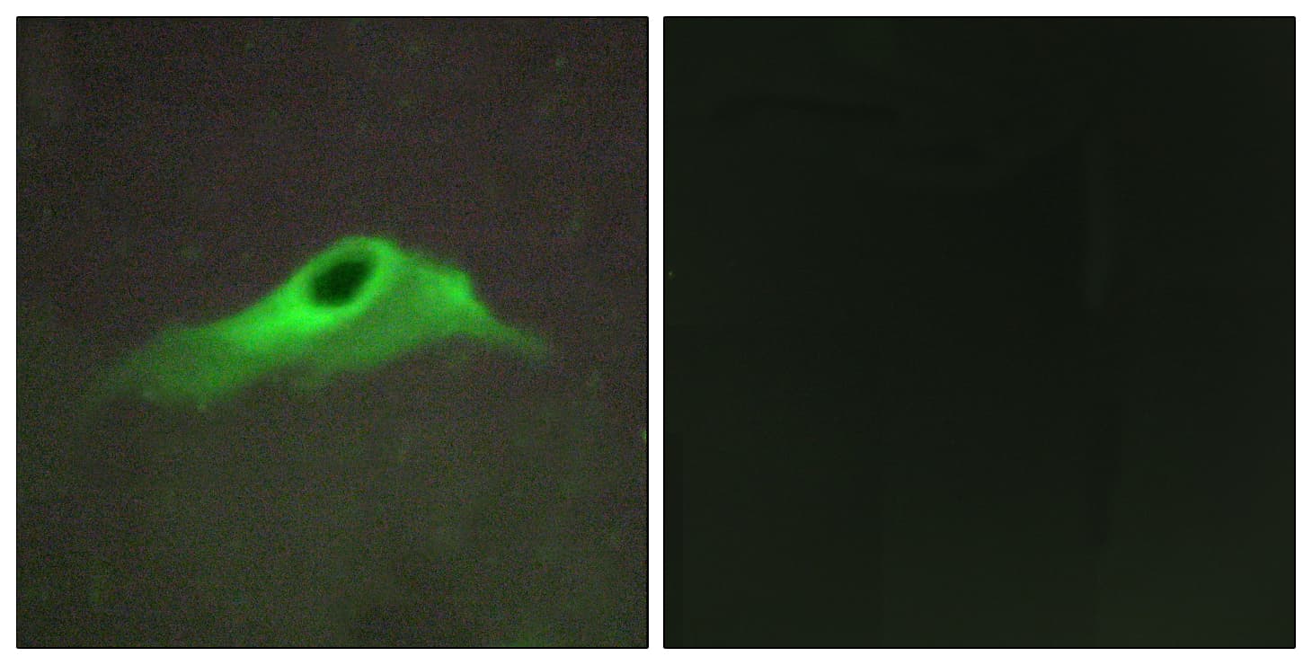 COL4A5 / Collagen IV Alpha5 Antibody (aa21-70)