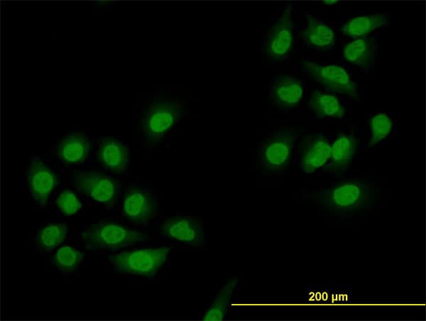 Monoclonal Mouse anti-Human SMAD4 Antibody (clone 3B9, IF, WB)