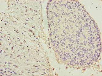 KRT33B / Keratin 33B / KRTHA3B Antibody