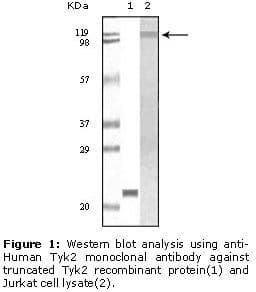 TYK2 Antibody (clone 8G8E9, 8G9H5)