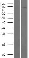 MIOS / FLJ20323 Protein (Over-Expression Lysate Myc-DDK (Flag))